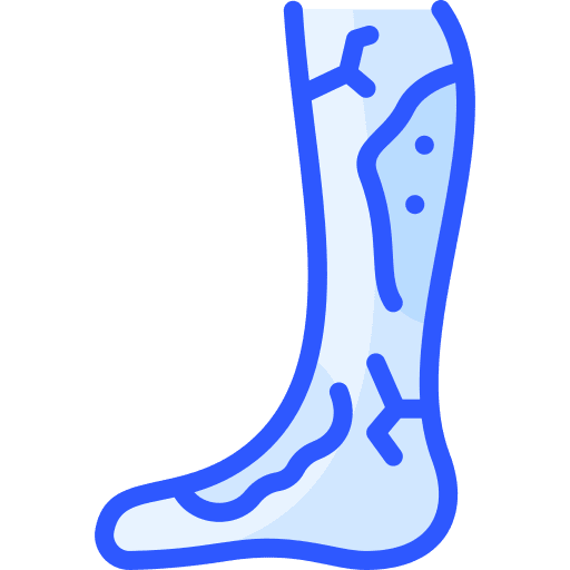 strains and sprains injury