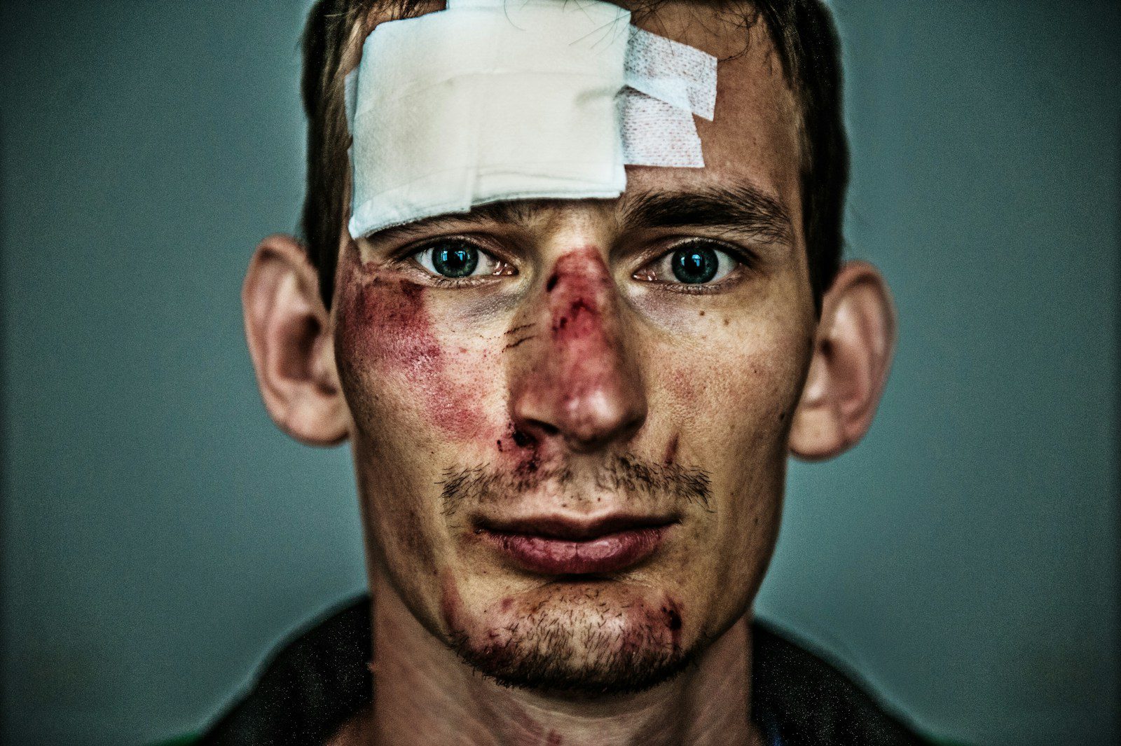 Our Services other injuries