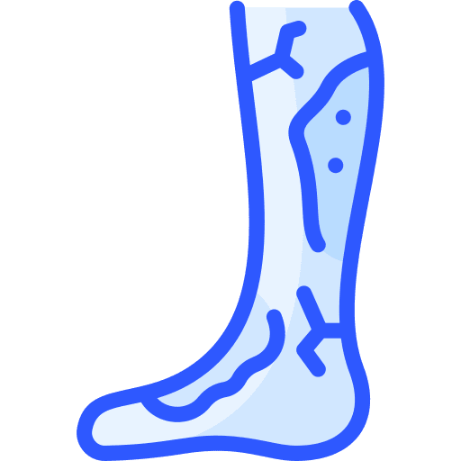 strains and sprains injury